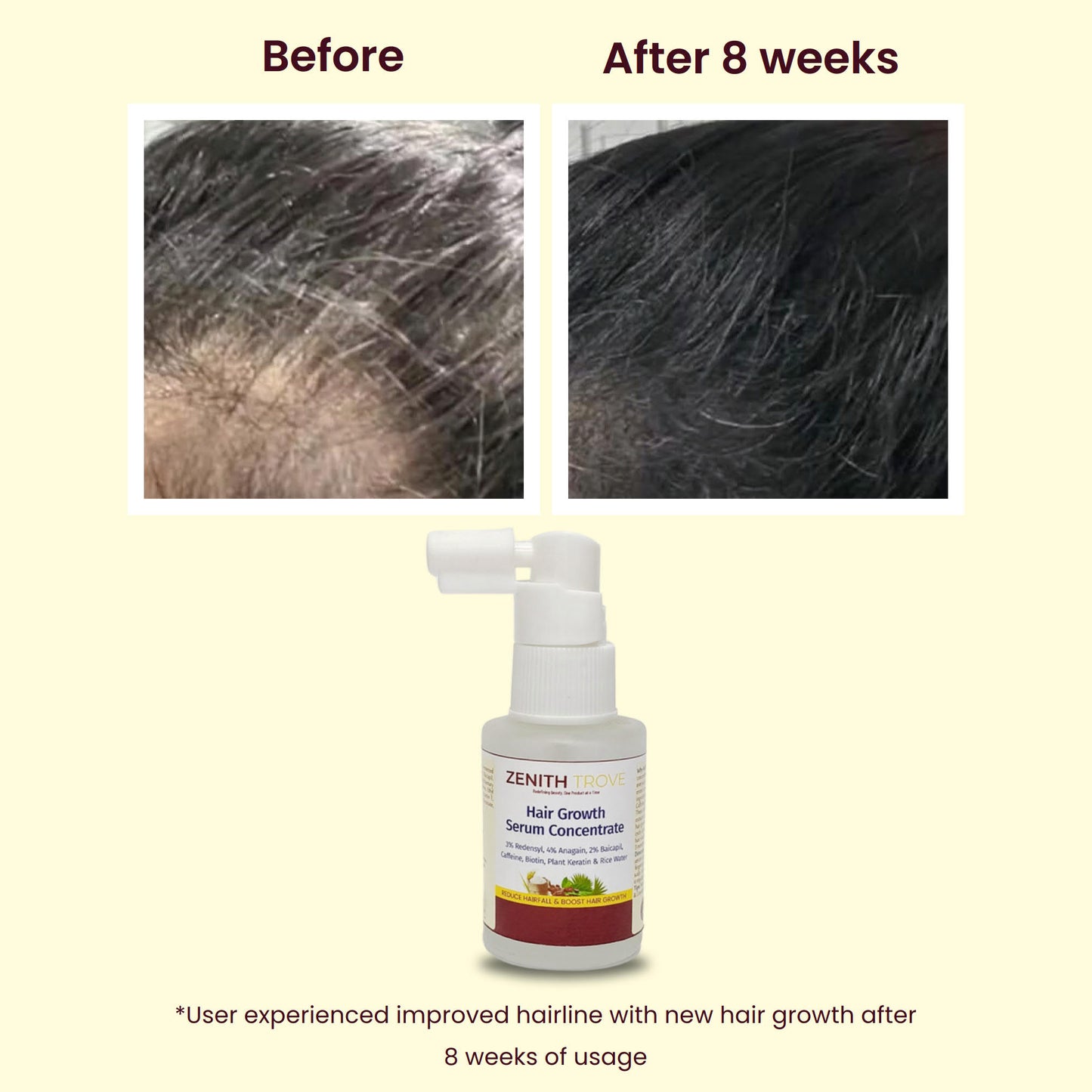 advanced hair growth serum concentrate