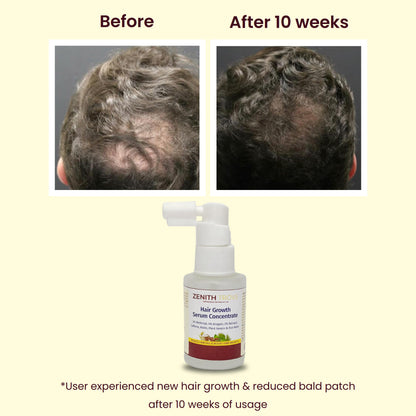 Advanced Hair Growth Serum Concentrate