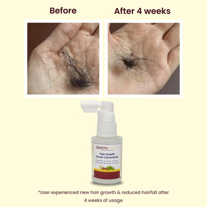 Advanced Hair Growth Serum Concentrate
