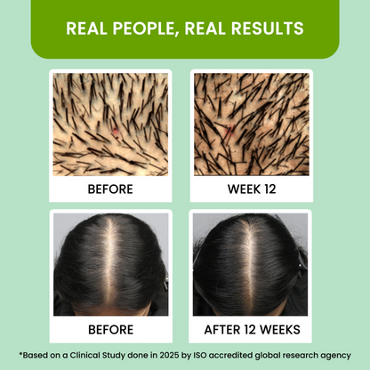 Rosemary Water Spray for Hair Growth & Thickness | Natural Herbal Hair Tonic for Men & Women | Anti Hair Fall & Scalp Care Mist – 100ml