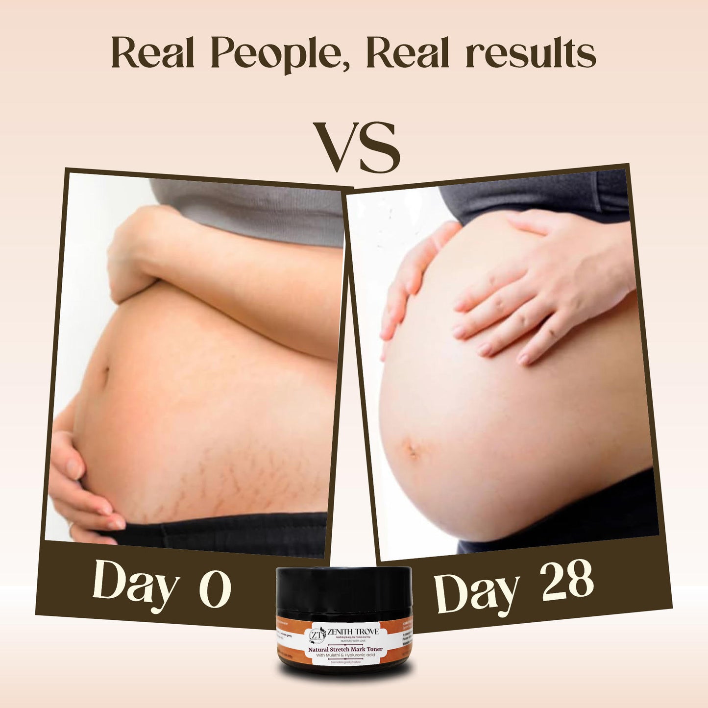 natural stretch mark removal toner cream