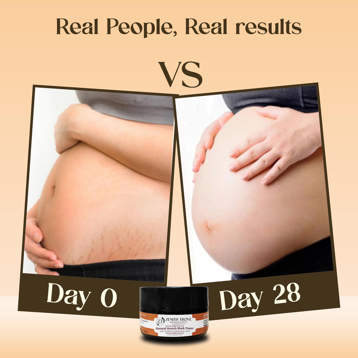 natural stretch mark removal toner cream