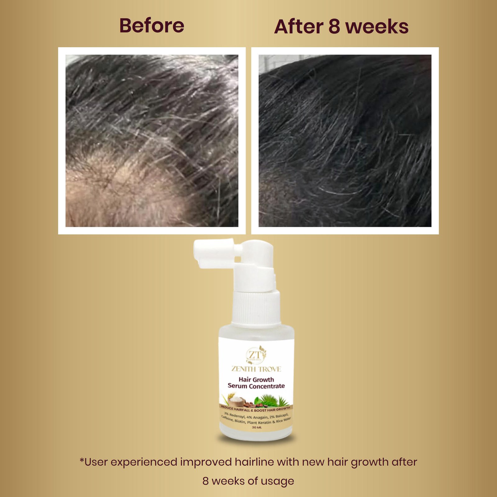 Hair Growth Serum Concentrate