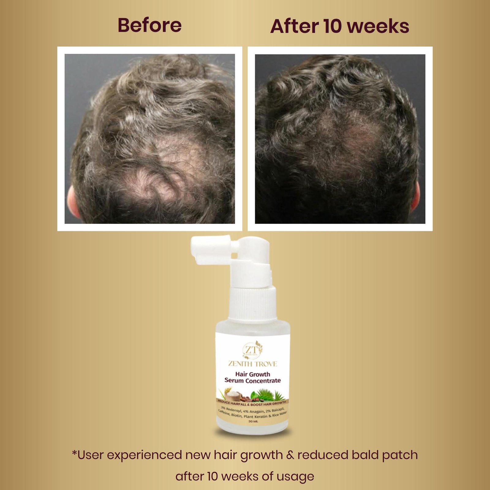 Hair Growth Serum Concentrate