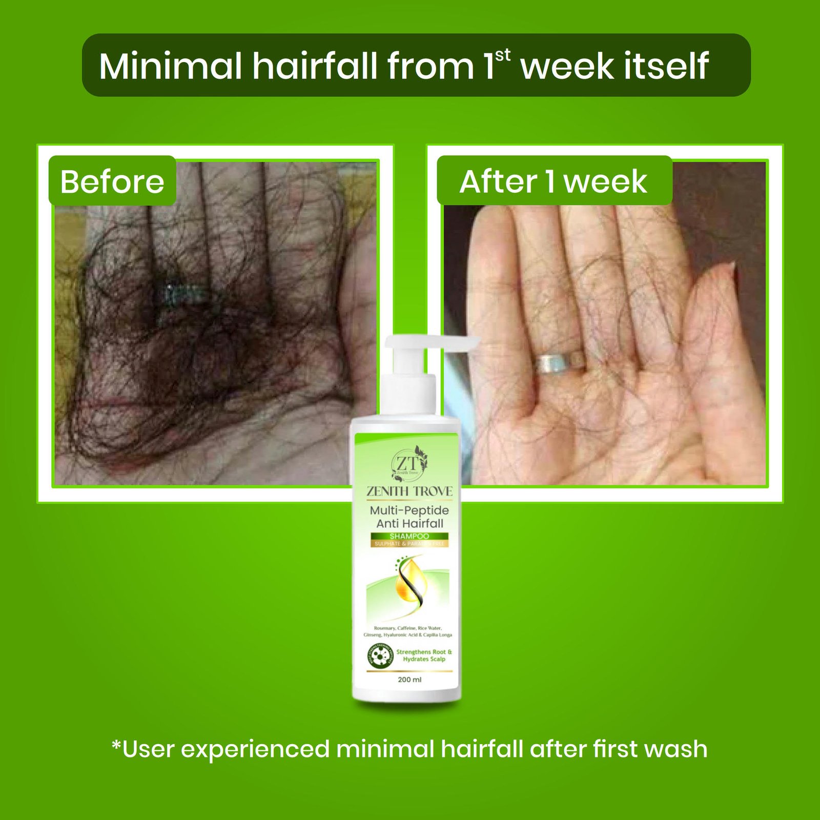Anti Hair Fall Shampoo